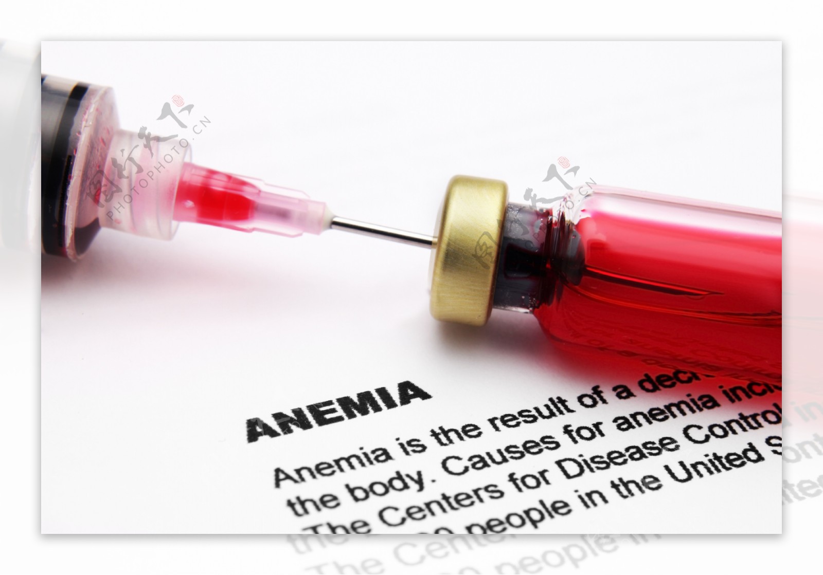 巨幼细胞性贫血(megaloblastic anemia, MA) | 重庆医科大学检验医学院在线教学中心