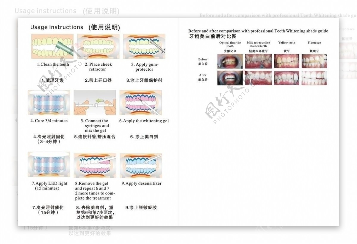 牙齿效果图图片