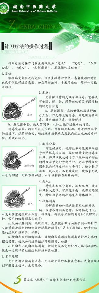 中医小针刀x展架图片