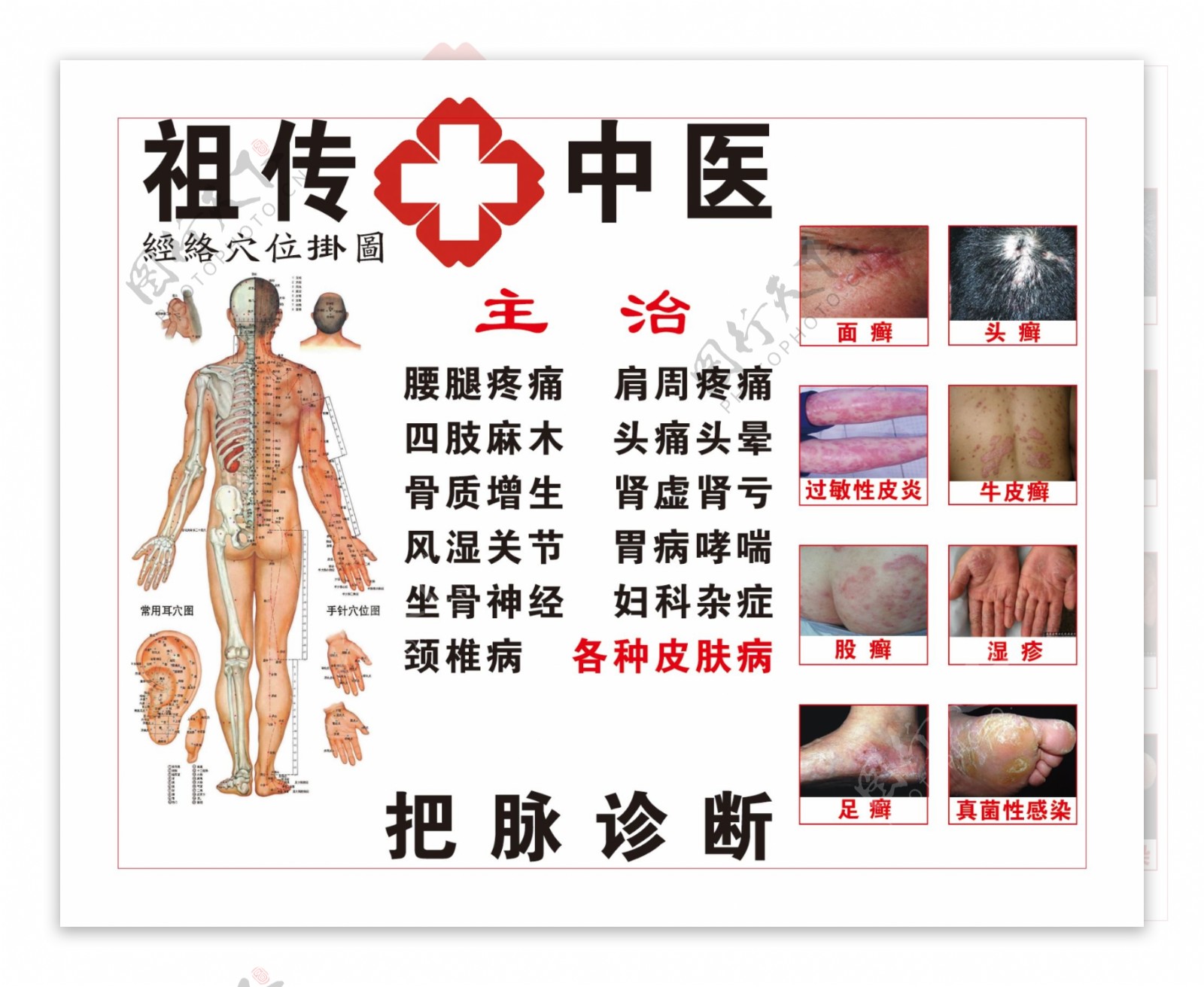 皮肤病广告图片