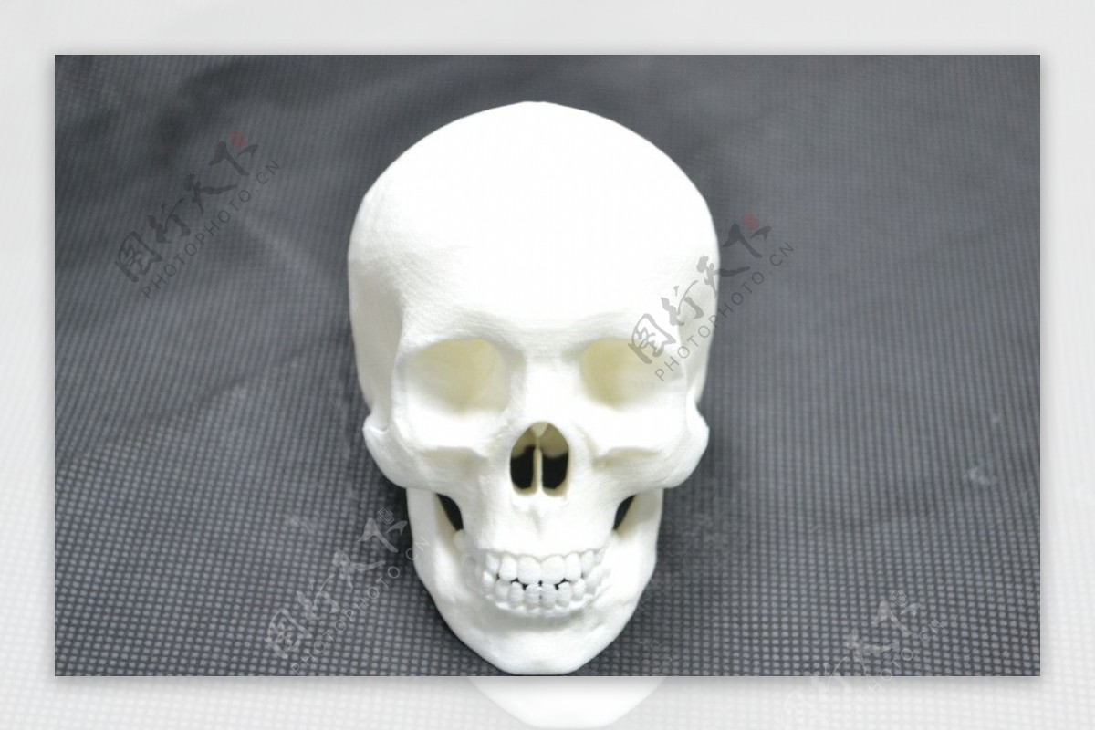 3D打印头盖骨图片