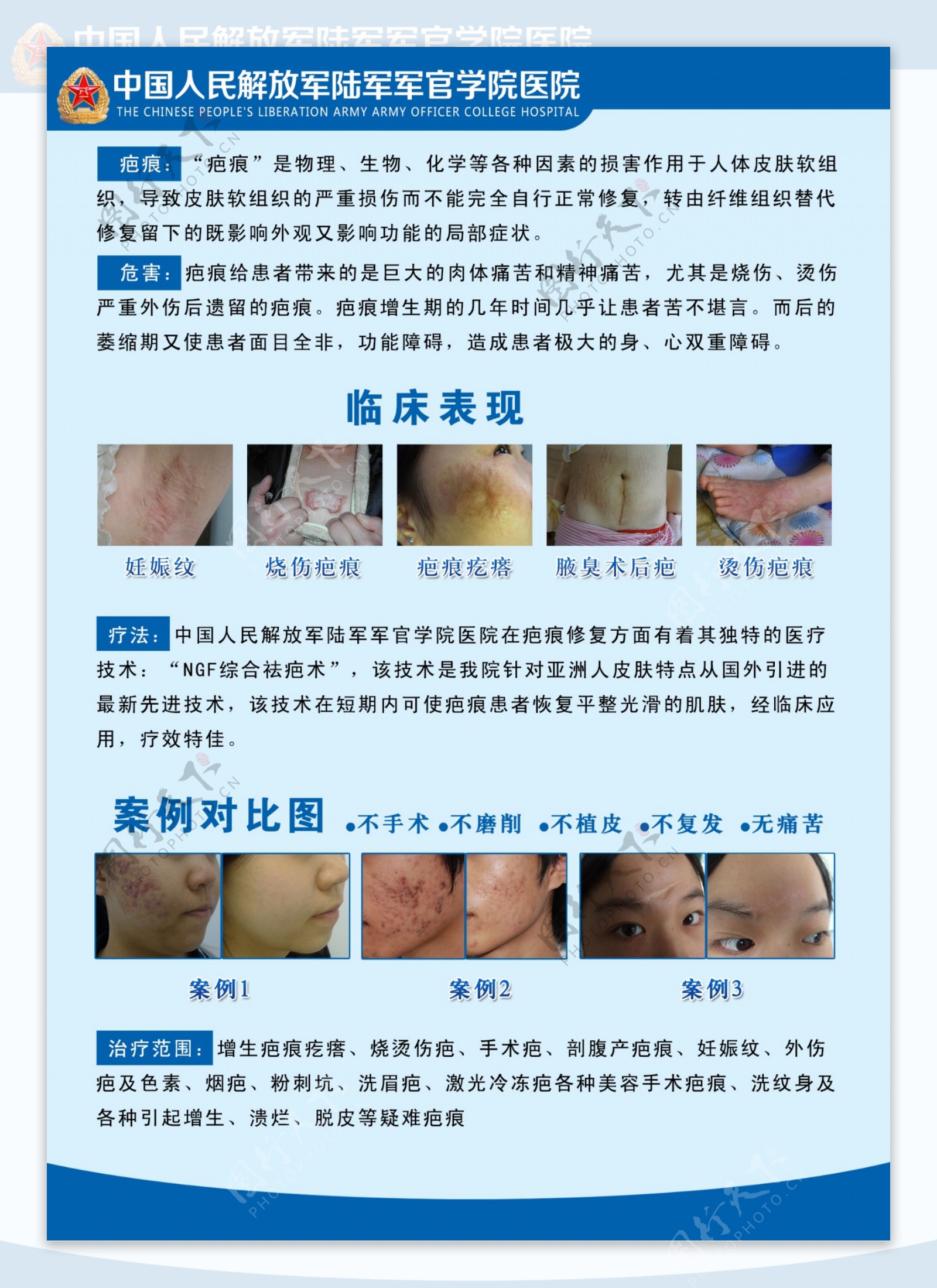 疤痕展板图片