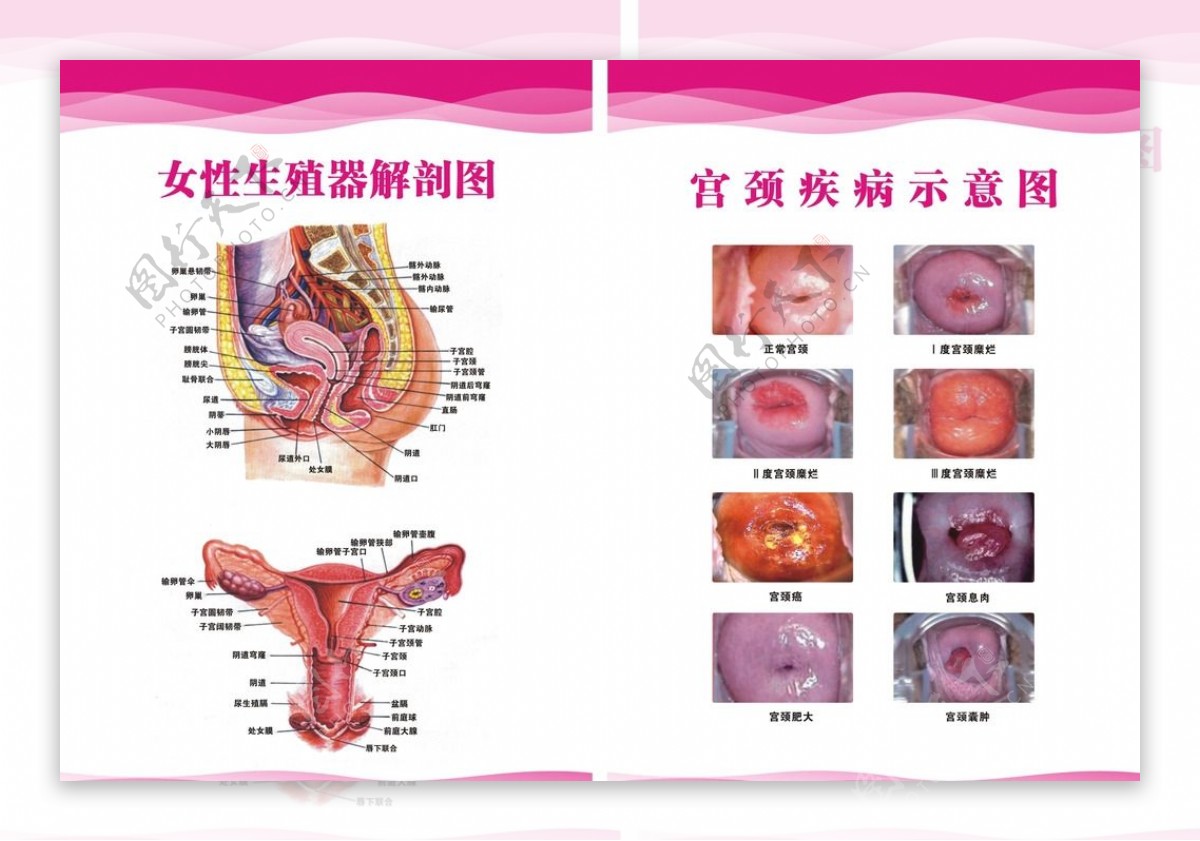 妇科解剖图宫颈糜烂图片