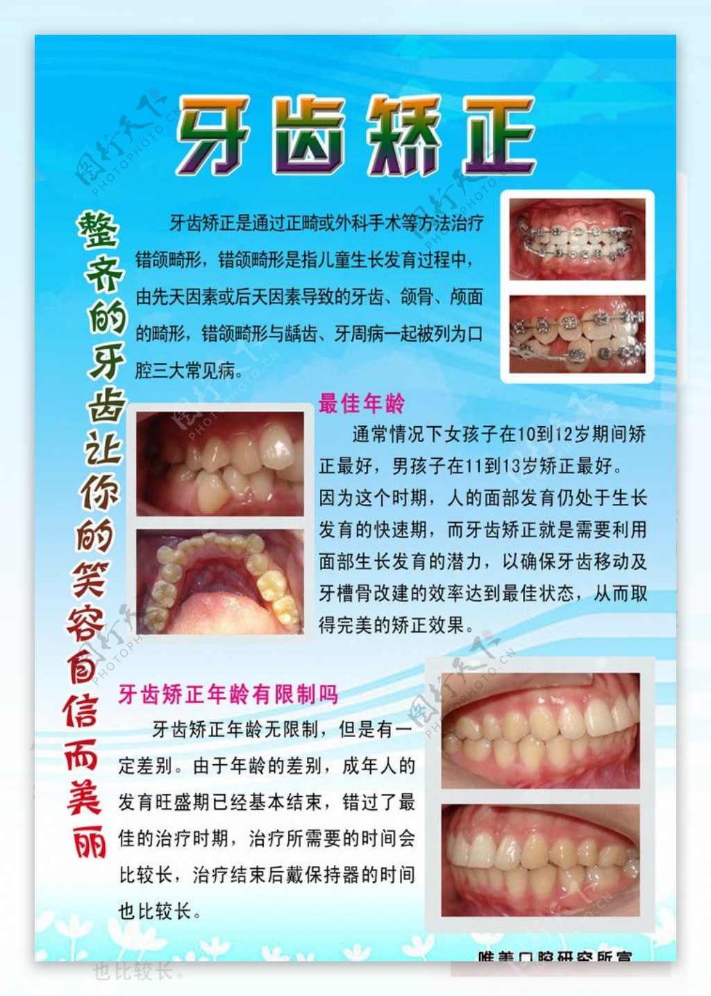 牙齿矫正