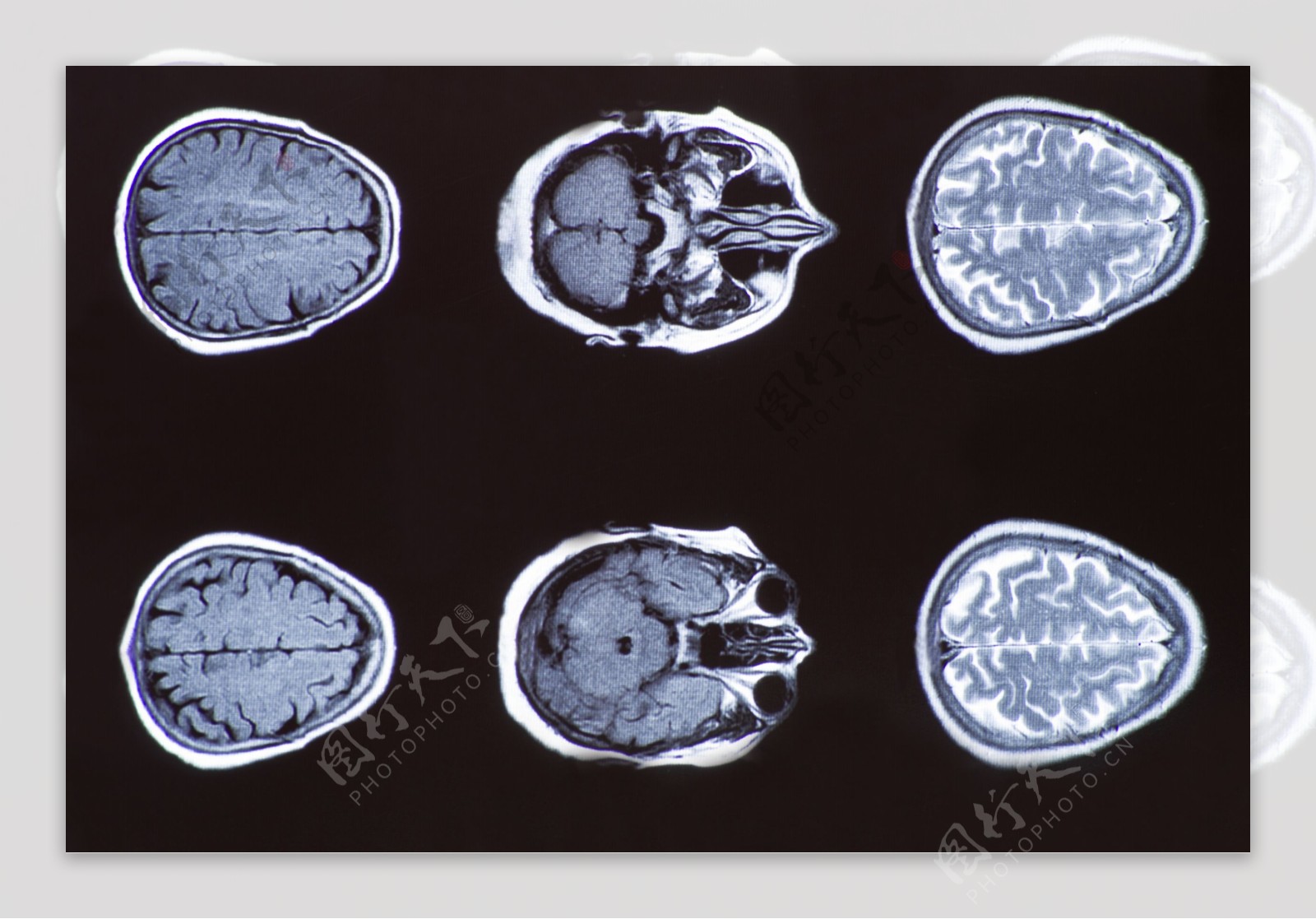 人体大脑拍片图片图片