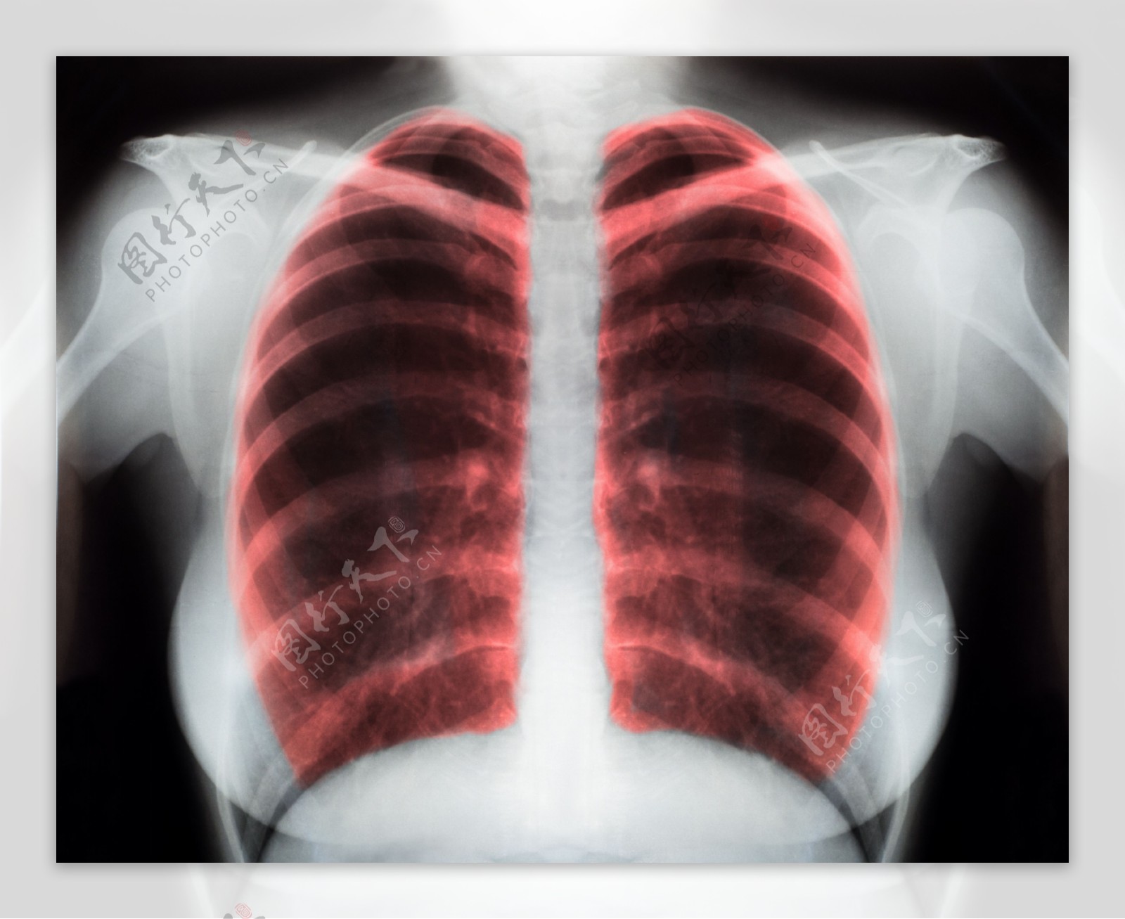 心肺器官图片