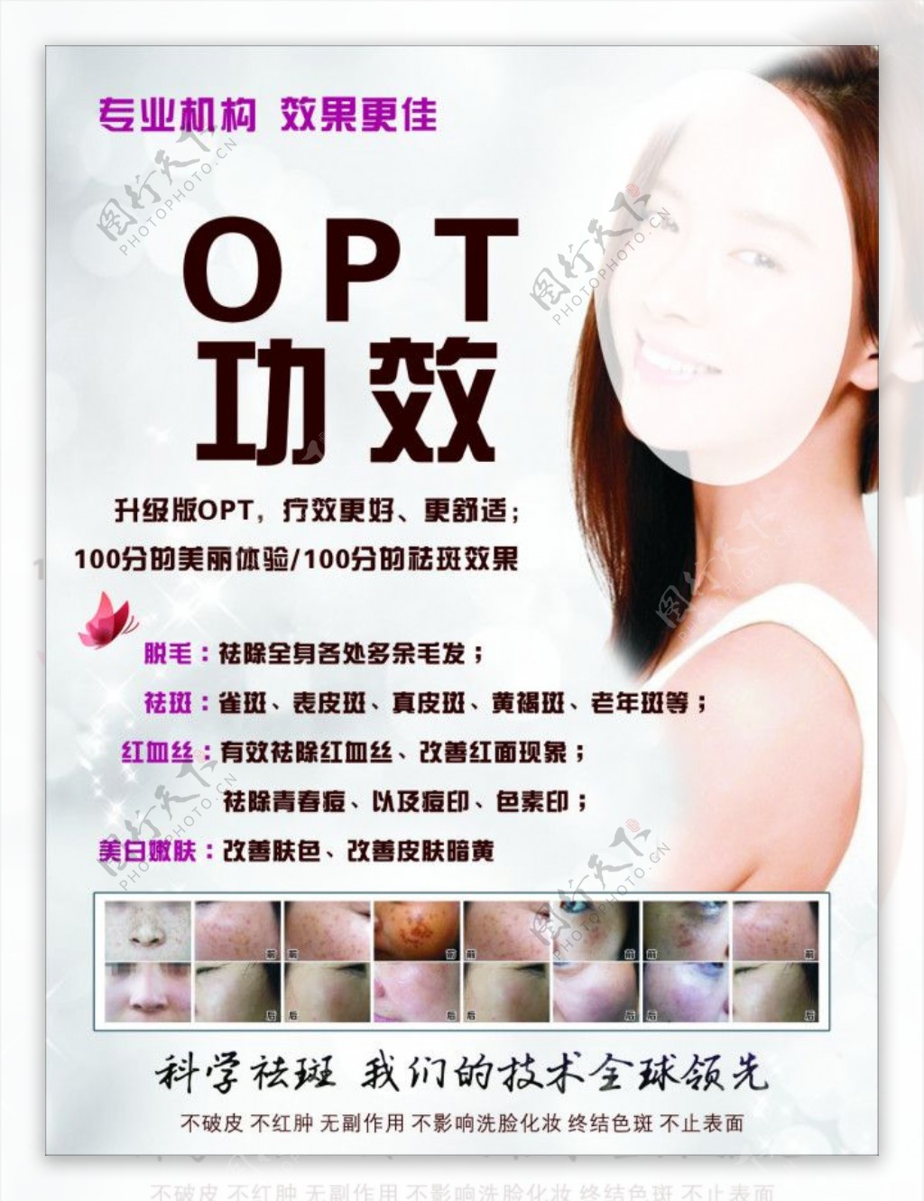 opt美容海报