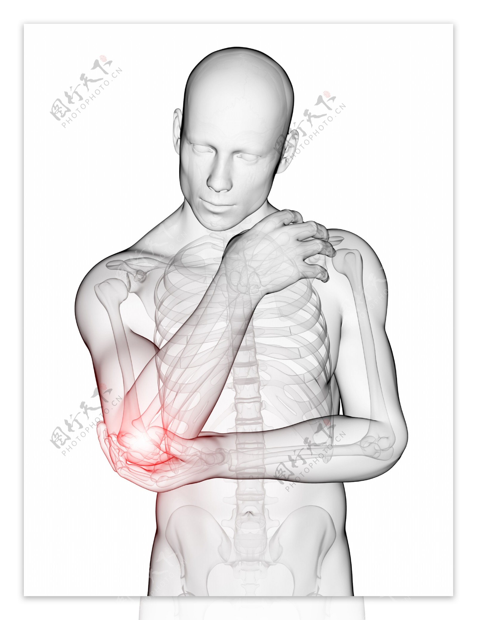 肘关节疼痛图片